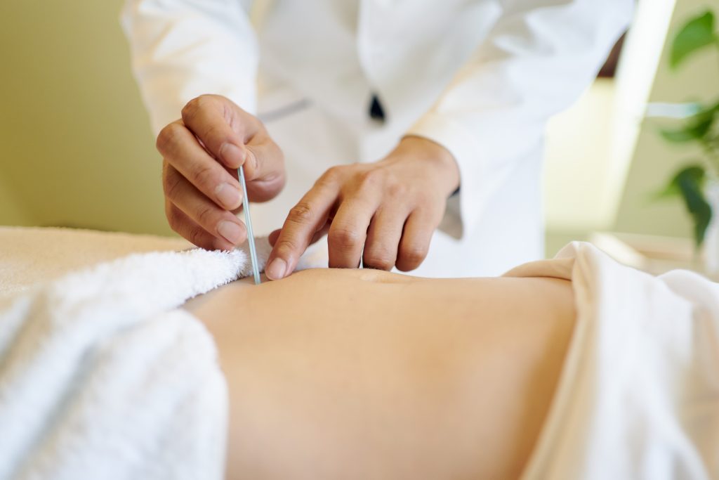 股関節痛に対しての鍼施術